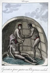 Operação para curar um Bojesmen - gravura
