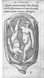A posição do feto no útero durante a gravidez. Gravura da "De la generation des enfants" do médico e cirurgião francês Ambroise Pare (1509-1590) Século XVI