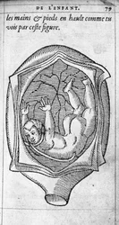 A posição do feto no útero durante a gravidez. Gravura da "De la generation des enfants" do médico e cirurgião francês Ambroise Pare (1509-1590) Século XVI