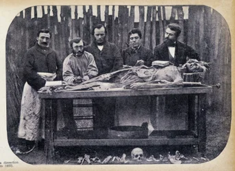 Dissecação, v.1865.