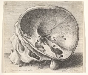 Crânio seccionado em perfil para a esquerda com o lado esquerdo do crânio removido, 1651.