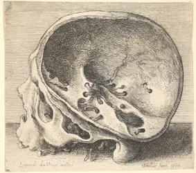 Crânio seccionado em perfil para a esquerda com o lado esquerdo do crânio removido, 1651.
