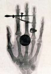 Radiografia de Wilhelm Röntgen da mão da sua mulher, 1896