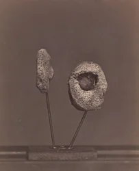 Joelheira Excised Knee Joint. Uma bola de mosquete redonda no côndilo interno do fémur direito [Gardin..., 1866-67].